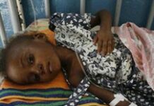 26 enfants meurent de malnutrition dans le sud-est